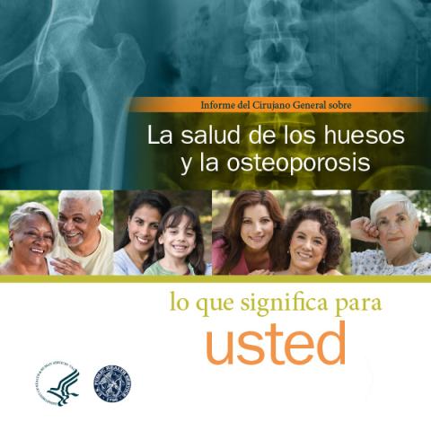Informe del Cirujano General sobre la salud de los huesos y las osteoporosis: lo que significa para usted